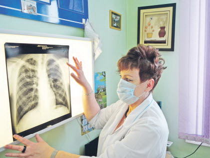 Флюорография и крепкий иммунитет - лучшая профилактика