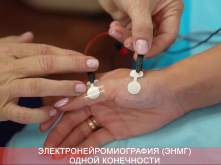 Что такое миография, кто направляет и проводит исследования - разбираемся на примере